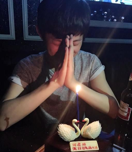 Angelababy出席活动右手伤疤醒目 教主黄晓明大呼心疼图片